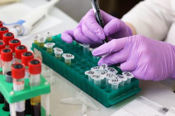 Componentes y funciones de la sangre y el sistema circulatorio